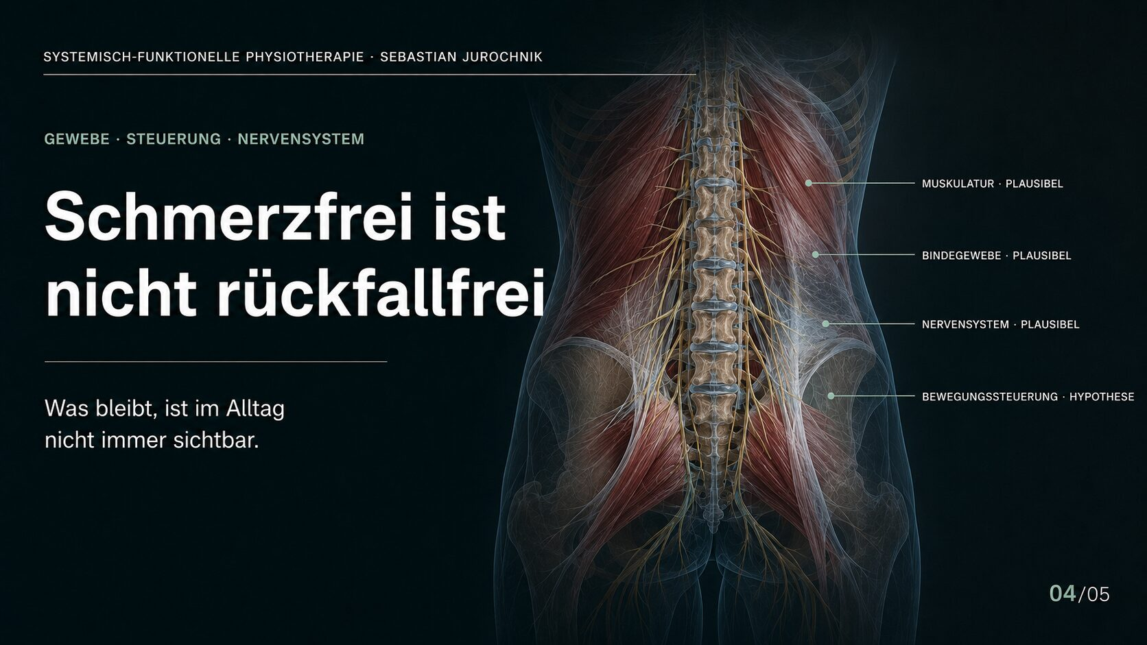 Muskulatur, Bindegewebe, Nervensystem und Bewegungssteuerung bei wiederkehrenden Rückenschmerzen